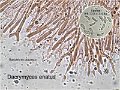 Dacrymyces enatus-amf2229-micro